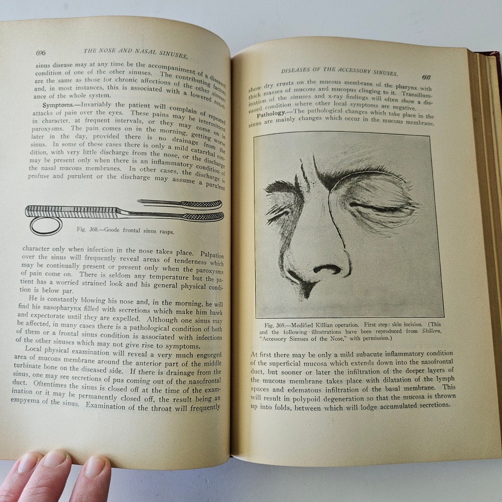 Diseases of the Ear Nose and Throat by Harold Hays 1926 HC Color Illustrations - Picture 10 of 11